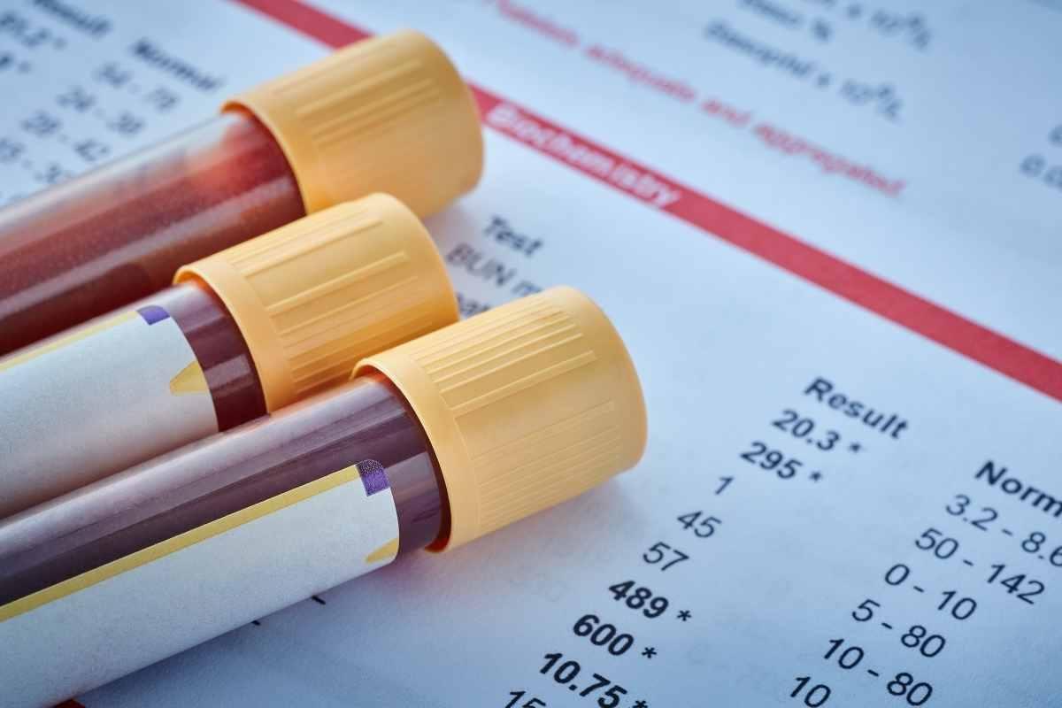 Üçlü Tarama Testi Ne Zaman Yapılır